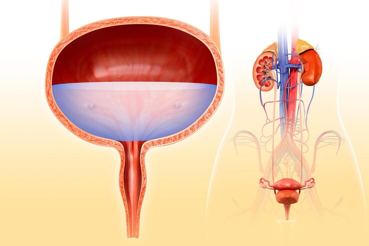 Neurogenic Bladder